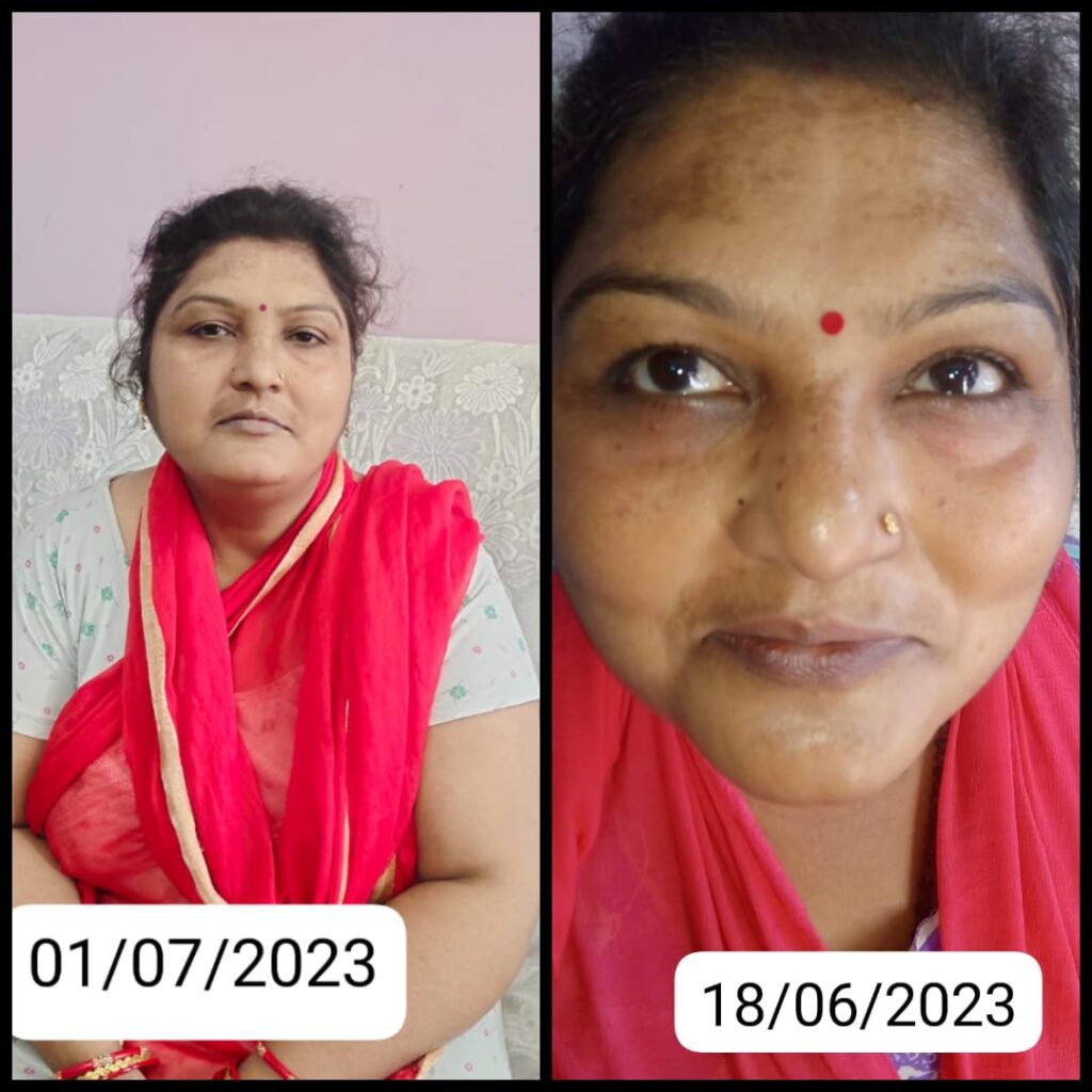 "Treatment Initiated by DD India Welfare Trust - A Ray of Hope for the Patient"