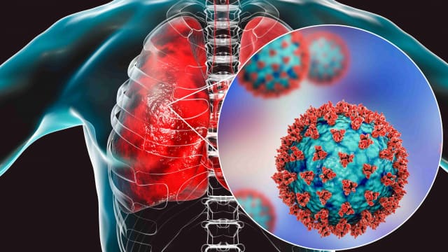 श्वास तंत्र चिकित्सक को सफल व उच्च स्तरीय रूप देने के लिये 15th क्रिटिकल केयर अपडेट 2023 का शुभारंभ