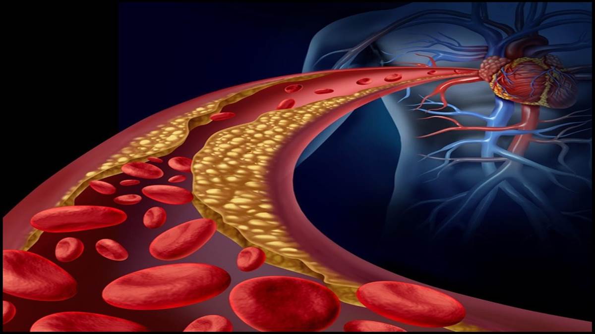 Understanding Cholesterol: Causes, Normal Ranges, and Research Insights