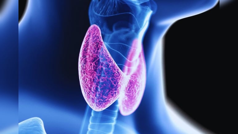 Causes of Elevated Thyroid Hormones and Associated Risks